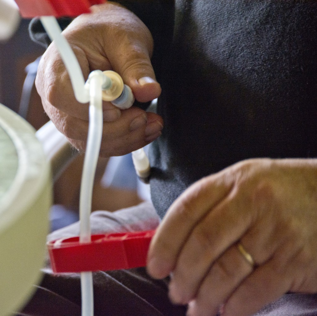 Adjusting clamps for peritoneal dialysis treatment